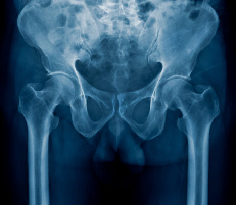 Diagnostic image of a patient's pelvic area.