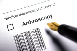 Arthroscopic Surgery
