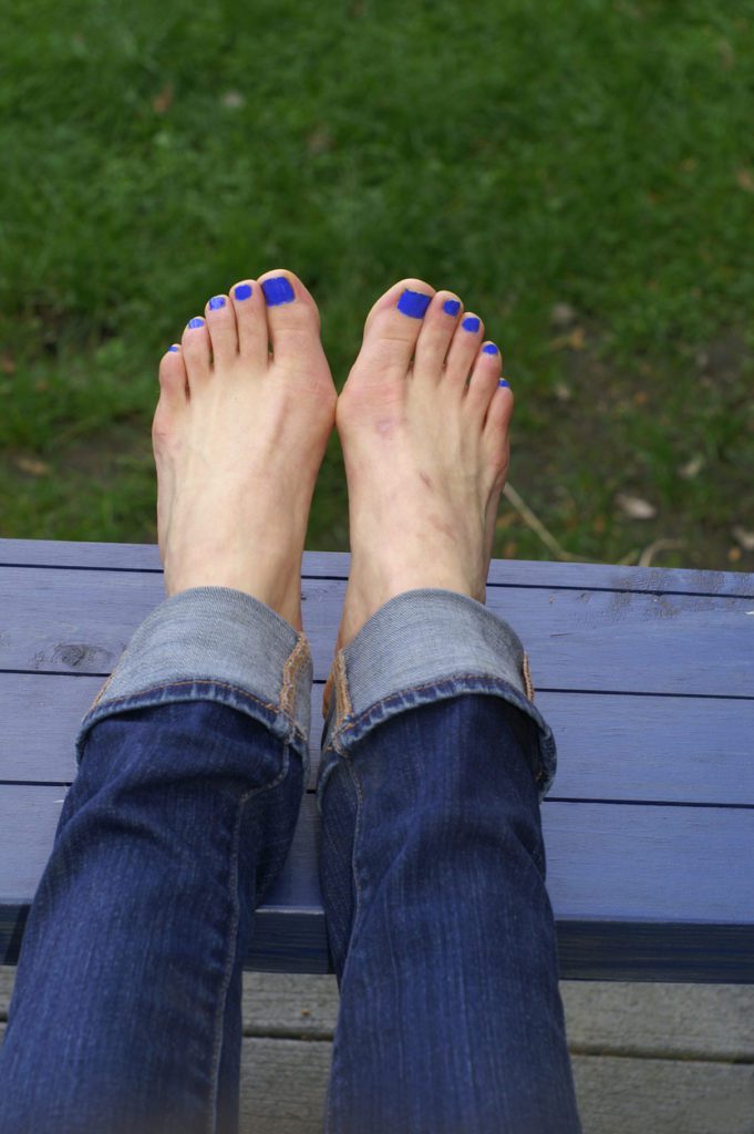 Two Feet with Bunions