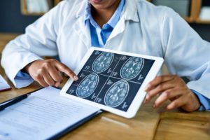 An orthopedic surgeon reviewing an MRI scan of a patient's brain.