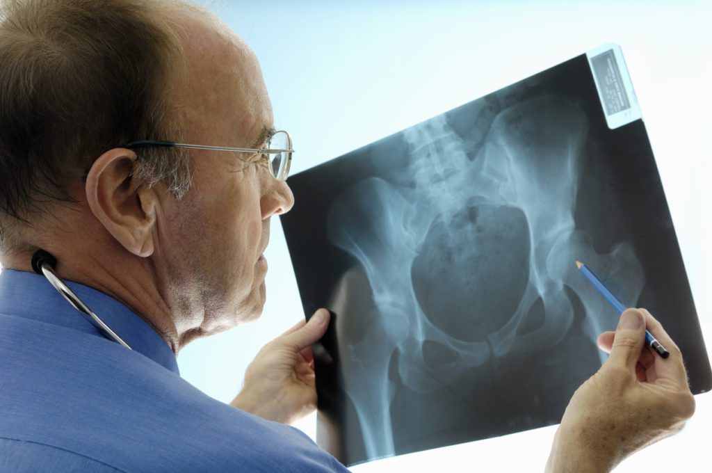 Orthopedic surgeon seeing the patient x-ray