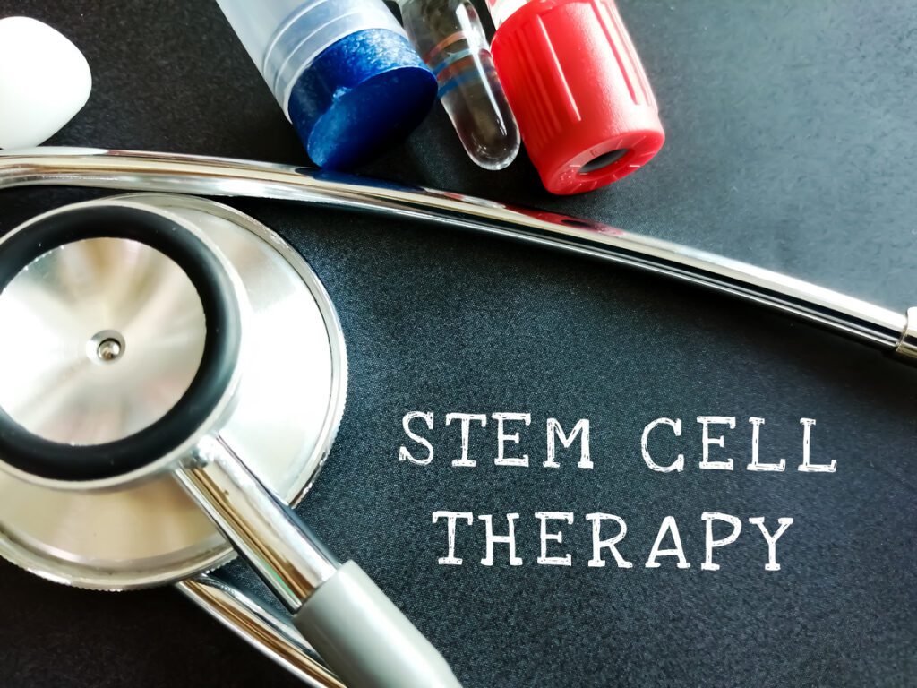 Stem Cell Therapy