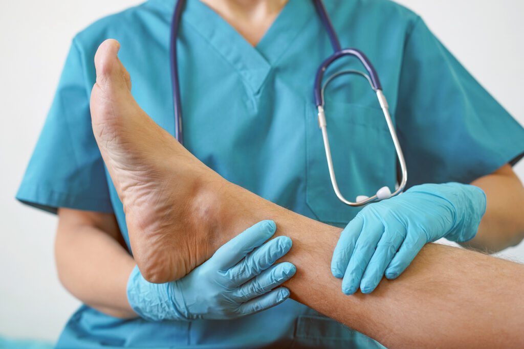 podiatrist holding infected foot with nail fungus for examination and diagnosis