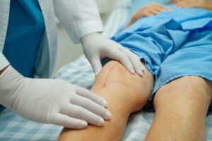 Doctor checking Asian elderly woman patient with scar knee replacement surgery in hospital.