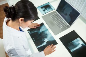 An Asian Chinese female medical doctor looking at x-rays of hip replacement and using laptop in a hospital