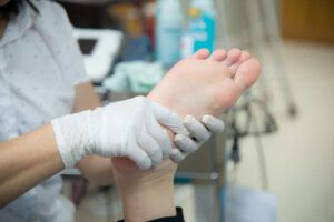 foot a patient held by a foot doctor with surgical gloves on