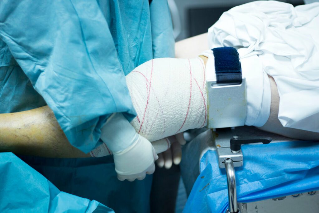 Knee Joint replacement surgery