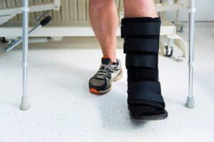 foot stress fracture in athlete