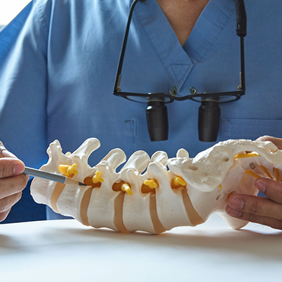 spine specialist showing signs of spinal stenosis in a spine 