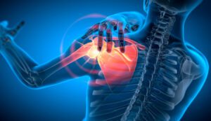 3D X-ray illustration of a man experiencing shoulder pain, depicting the procedure for arthroscopic shoulder surgery.