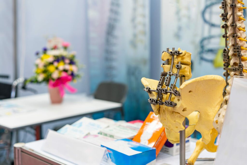 A sample structure show hip bone and spine bone with metal fixation set on table.