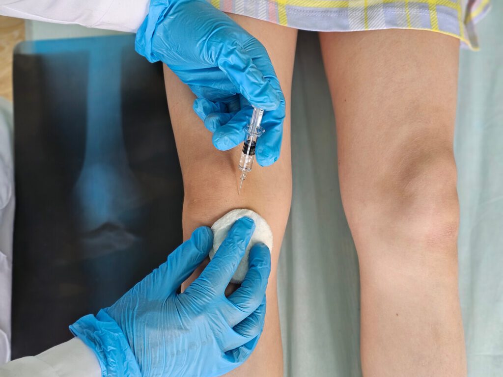 A medical professional wearing gloves is administering an injection similar to Plasma-Rich Protein injections to a patient's knee.