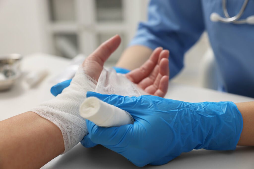 A hand doctor is bandaging a patient's burned hand in the hospital.