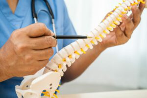 A spine doctor holding spinal nerve and bone model to explain an herniated degenerative disc disease.