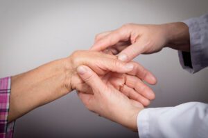 Hand Deformed From Rheumatoid Arthritis